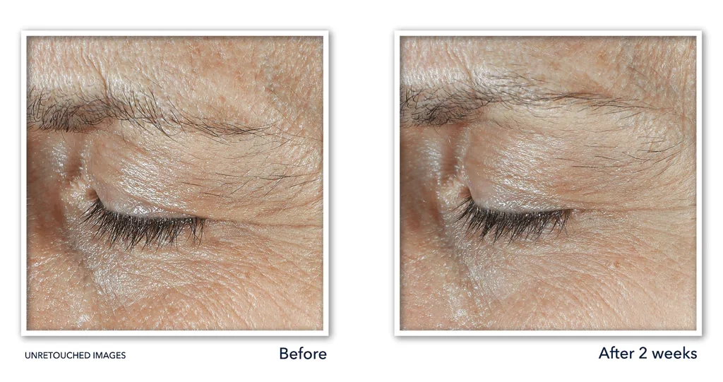 Risultati RoC Skincare Derm Correxion contorno occhi